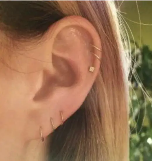 Extensive Piercings of the External Ear