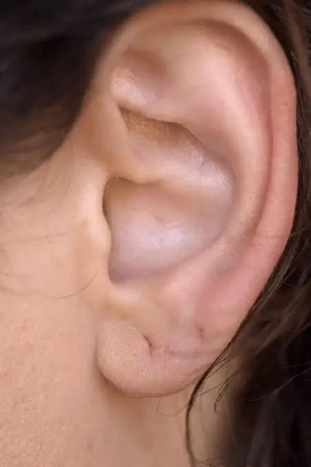 Earring hole