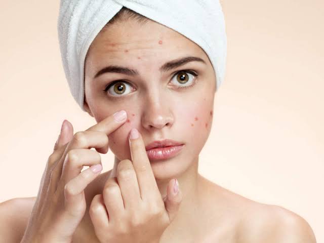 Women hiding pimples with makeup